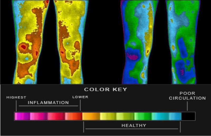 Earthing and grounding the body scans on inflammation improvement.