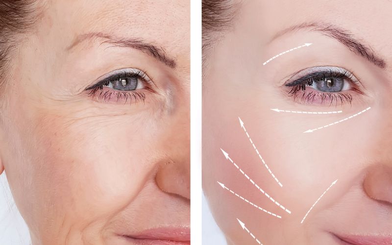 Red light therpay and infrared how it improves skin health.